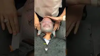 Sıcak Maske Y&uuml;zde Sabitleniyor, Radyoterapi Kolayl