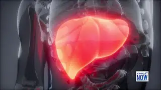 Liver Cancer Awareness Month