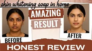One time use we can get glowing,whitening, glassy skin||Skin whitening soap in home||@moonglowMK