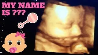 ULTRA SOUND 2.0 IN 3D (BABY'S NAME ANNOUNCEMENT)