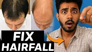  &ldquo;5 Hairfall Mistakes Every Man Is Making (Stop These TODAY)&rdquo;⭐️