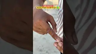 Finger cut by Bareilly Dragon #youtubeshorts #bareillydragon #bareillymanjha #monokitefighter #kite