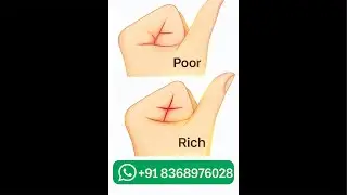 Millionaire Sign in Your Hand? | Crorepati Rekha | Palm Reading Secrets 🔮 दुनिया की सबसे खोजी