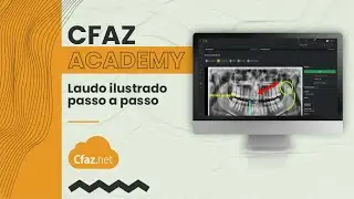✏️ Como Usar o Laudo Ilustrado no Cfaz.net | Passo a Passo Completo