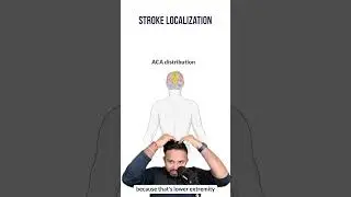 Stroke Localization for the USMLE | HyGuru