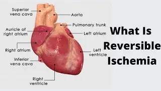 Was ist reversible Isch&auml;mie?