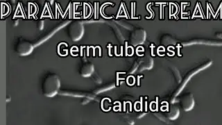 GERM TUBE TEST