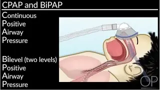 Как применять СИПАП и БИПАП-терапию дома (Л. Перлман, Б. Уолш) | OPENPediatrics