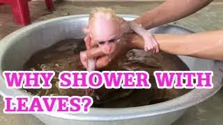 Treatment for monkey rash?