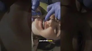 Orthodontic Insurance, Fast Facts #orthodonticbraces #dentalinsurance  #youtubeshorts