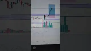 How To FVG Bullish Reverse 📉📈 बुलिश रिवर्सल पैटर्न