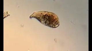 Microscopy - The Spathidium