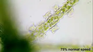 Hydra Viridissima with Trichodina Pediculus
