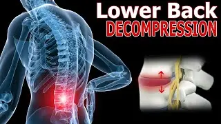 Unlocking Spinal Relief: Affordable Alternatives to Inversion Tables and Traction for Decompression