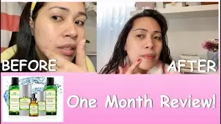 How to get rid of dark spots? | Tree of life beauty: Vitamin C review!