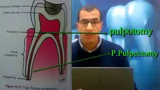 ال pulpotomy في 5 دقائق