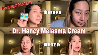 Dr. Hancy Melasma Cream Product Review #vlog #vlog3 #skincare #skincarereview #skincareproductreview