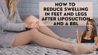How to reduce swelling in feet and legs after liposuction and a Brazilian Buttocks Lift?