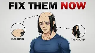 Stop Hairline Recession in 120 Seconds | Proven Tips to Save Your Hair Fast