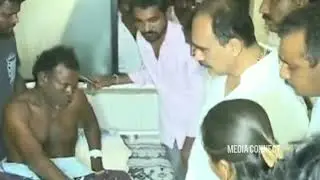 YSRCP ongole MLA balineni Srinivasas Reddy visits hospital to console ycp activist l media connect