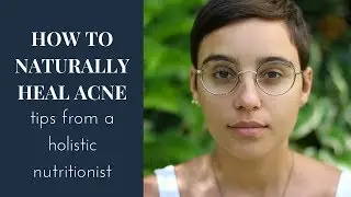 How to naturally heal acne: Tips from a holistic nutritionist