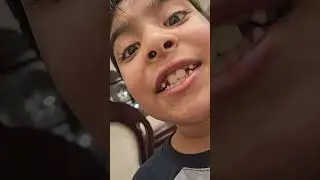 a ball Drone  and more #funny