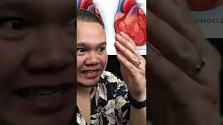 SADO PUN BOLEH KENA SERANGAN JANTUNG, BUKAN ORANG OBESE SAJA.