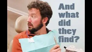 Man goes to dentist for the first time in 37 years!