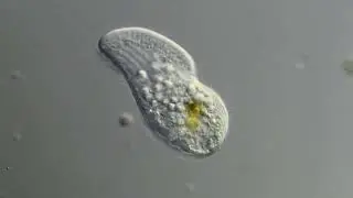 Spathidium