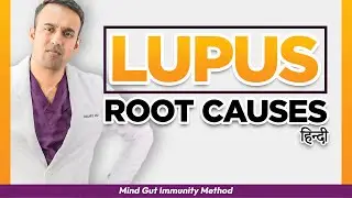 [Root Causes] of Lupus, SLE Autoimmune ANA+ Genetics & Inflammation, Medical Doctor Explains hindi