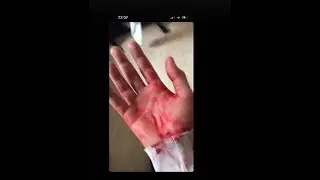 #boulevard #toto #maroc 💔😥⚔🩸 أفظع مشاهد الفوضى والتشرميل في مهرجان البولفار  غتاص*و ليا ختي قدامي