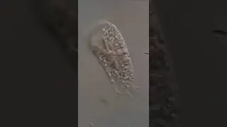microscopy video - ciliate hypotrich