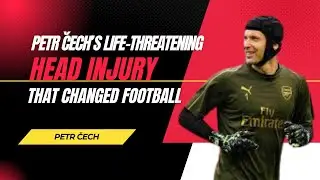 Petr Čech&rsquo;s Life Threatening Head Injury That Changed Football