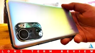 [HINDI] Xiaomi Mi 11X Review after long term use!