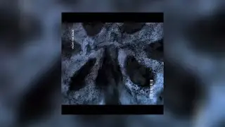 Devvo- Fight the rage 