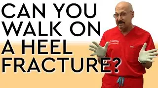 Can You Walk On A Heel Fracture?