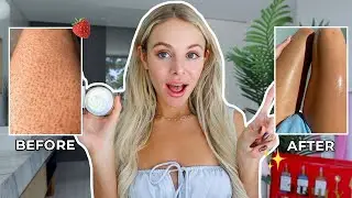 How I Smoothed Out My KP | Truly Beauty Skincare Routine!