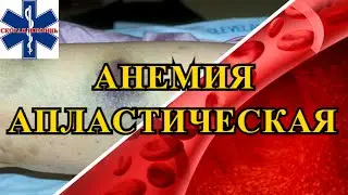 Апластическая анемия