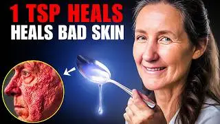 1 TSP CURES Your Skin Problems in Just 7 Days! | Barbara O'Neill