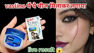 इस तरह से अपने चेहरे पर वैसलीन लगाएं और आपका चेहरा😱 इतना गोरा हो जाएगा कि हर कोई देखेगा....
