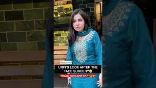 Urfi&rsquo;s face after face surgery & Botox|This is how traditional clothes makes you look beautiful