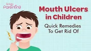 Mouth Ulcers (Canker Sores) in Children - Causes, Symptoms  & Treatment
