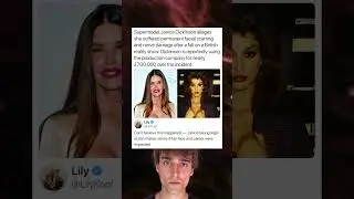 Supermodel Janice Dickinson alleges she suffered permanent facial scarring and nerve damage