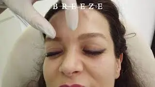 Mimik Kırışıklığı Tedavisi - Breeze Clinic