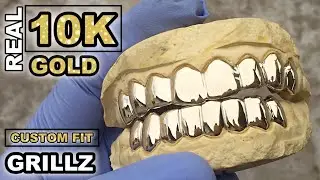 Solid 10K Gold Grillz Custom Fitted Grills Set For Teeth