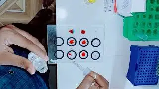 Blood Grouping Rh Typing...