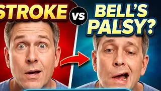 Why Does Stroke Spare the Forehead? 🤯