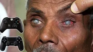 Video Games DO Damage Your Eyes?