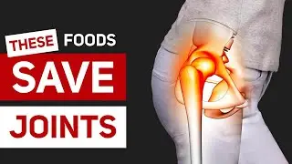These Foods Will Save Your Joints: How to Get Rid of Pain and Restore Cartilage