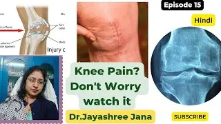 Awareness about Knee Pain with Diet Advices /Hindi @BeHealthywithDrJayashree